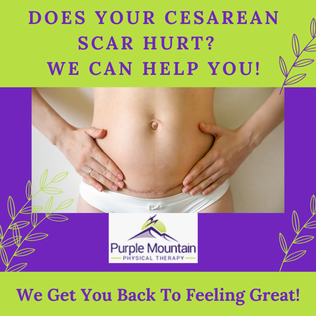 Should My C-section Scar Still Hurt? - Purple Mountain Physical Therapy